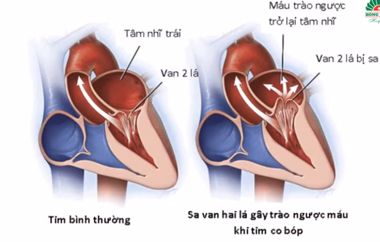 khoe-manh-tim-2.png