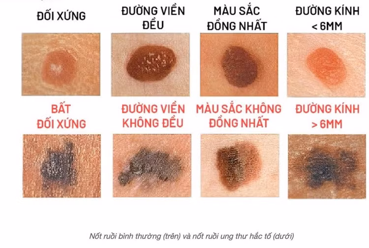 not-ruoi.jpg