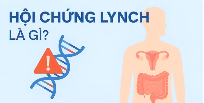 hoi-chung-lynch.png