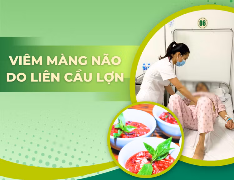 viem-mang-nao-113809-220925-86.png