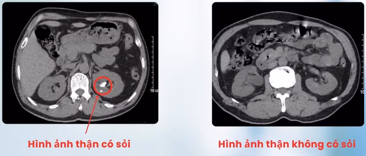 than-doi-1.jpg