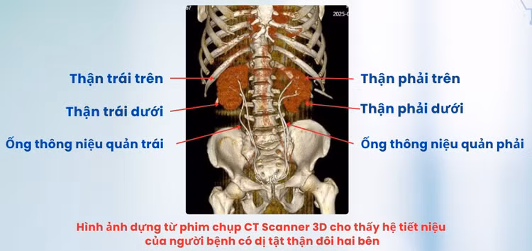 than-doi-2.jpg