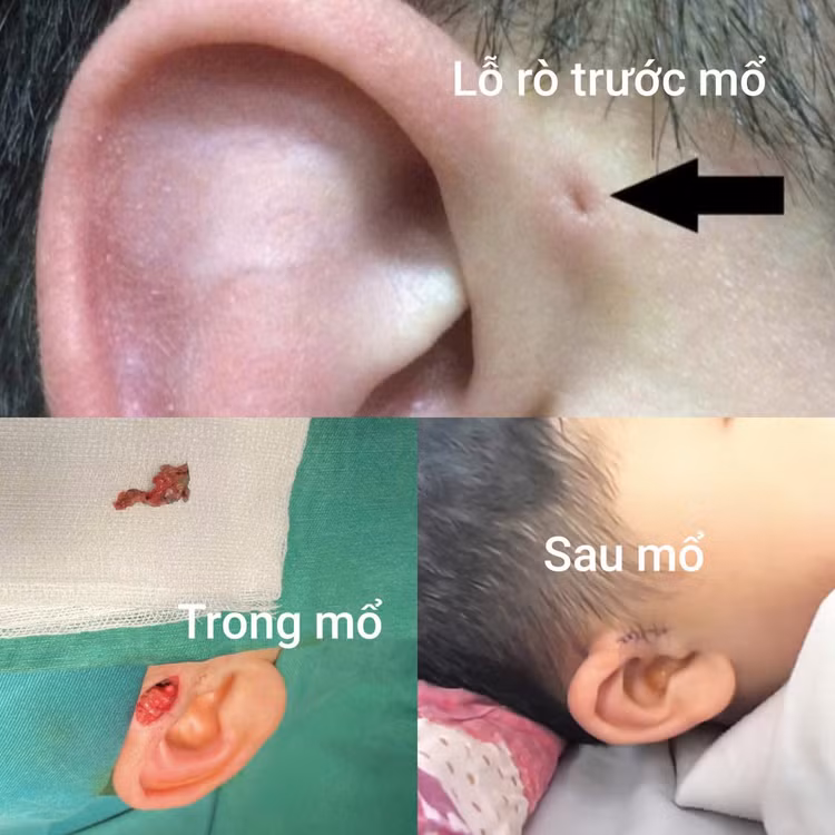 ro-luan-nhi.jpg