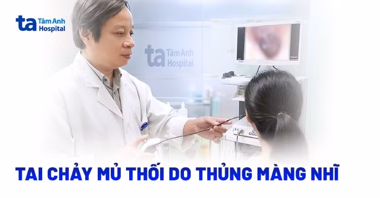 tai-chay-mu-1.jpg