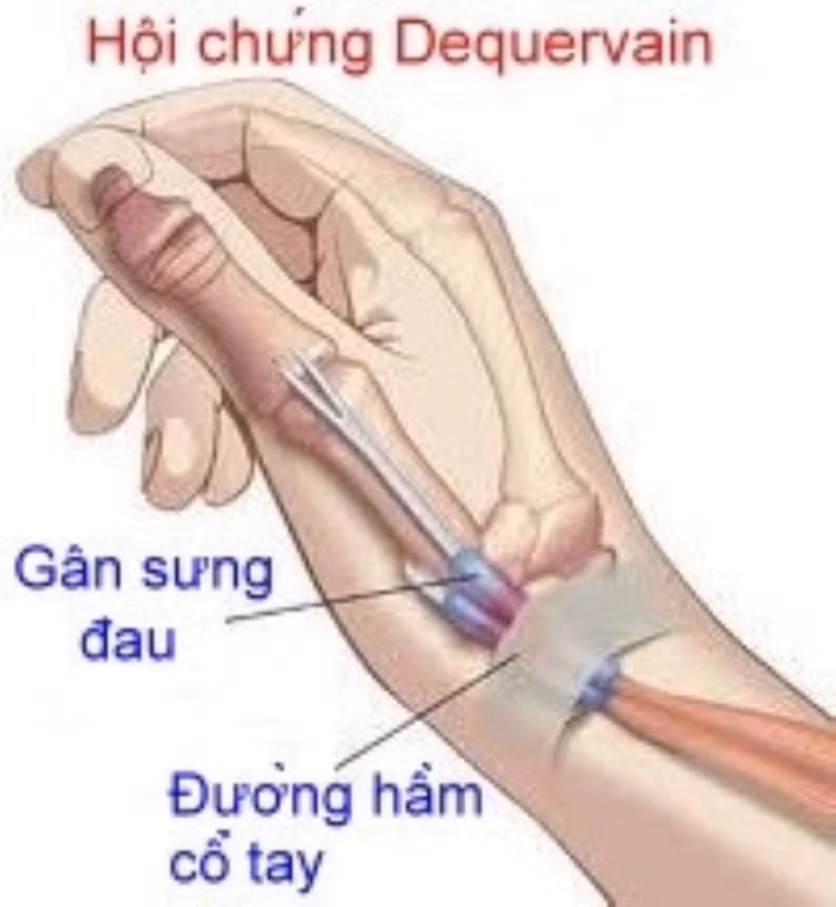 anh-1.jpg