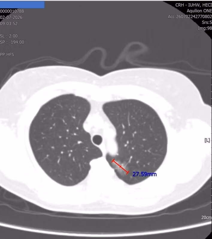 ut-phoi.jpg