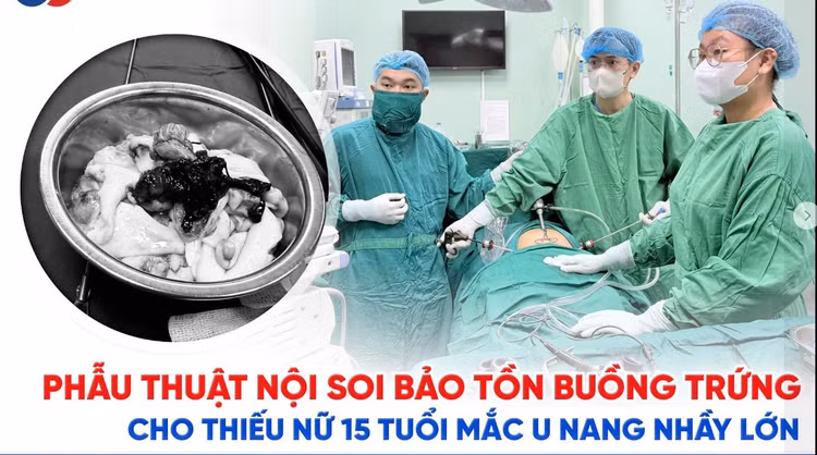 u-nang-nhay.jpg