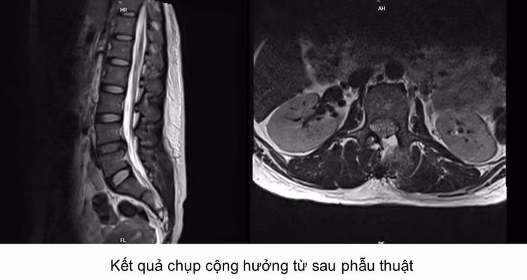 u-tuy-7706.jpg