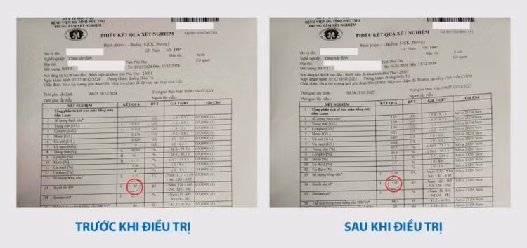 da-u-tuy-xuong.jpg