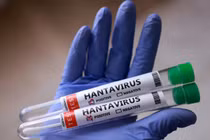 WHO cảnh báo về nguy cơ lây nhiễm Hantavirus trên tàu du lịch