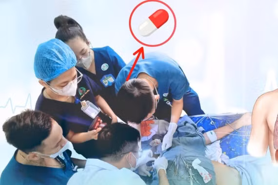 Ung thư hạ họng, bệnh nhân nguy kịch vì viên thuốc mắc đường thở