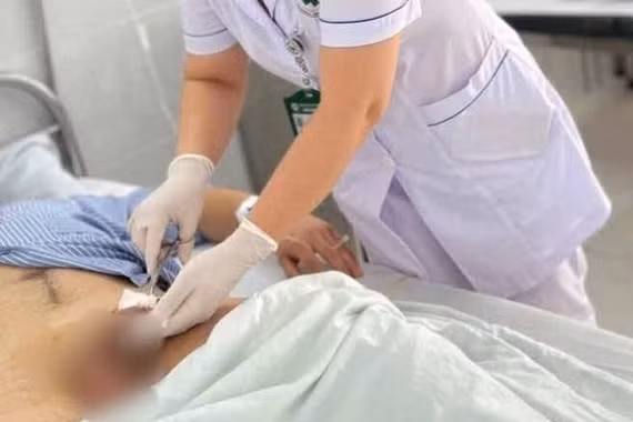 Cảnh báo chấn thương niệu đạo do đặt sonde tiểu sai kỹ thuật