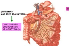 Chữa thành công bệnh hiếm gây tắc nghẽn ruột bằng phẫu thuật tại TP HCM