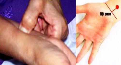 Alzheimer - nỗi lo của người cao tuổi