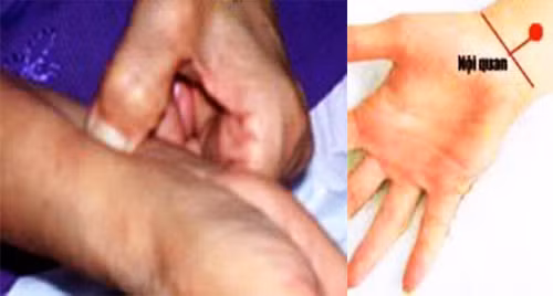 Alzheimer - nỗi lo của người cao tuổi