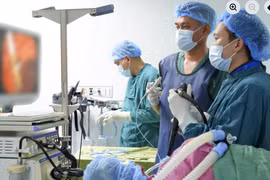 Hiếm gặp, tắc mật do stent di lệch
