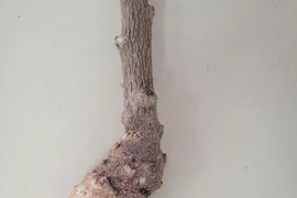 2 người ngộ độc, phản vệ vì chữa bệnh bằng cây dân gian