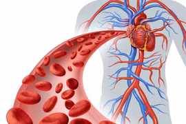 Hậu quả khó lường khi tuần hoàn máu kém không xử lý