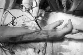 Dựng cây nêu đón Tết hai vợ chồng ở Nghệ An bị điện giật nghiêm trọng