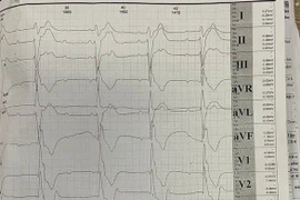 Cao gầy, sụp mí mắt, chàng trai 19 tuổi mắc hội chứng Kearns–Sayre hiếm gặp