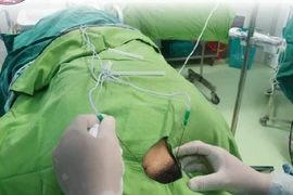 Đau dây thần kinh chẩm, nguồn cơn của những trận 'đau đầu'