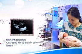 Cuộc đua với tử thần khâu cổ tử cung đã mở 3cm để giữ mầm sống 26 tuần