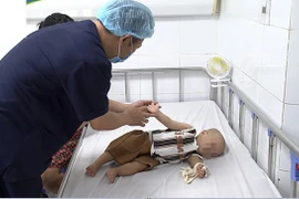 Bệnh tay chân miệng vào mùa, trẻ mắc lại nhiều lần, cha mẹ cần làm gì?