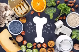 Bác sĩ mách các nhóm thực phẩm giúp giảm viêm, tránh đau cơ xương khớp