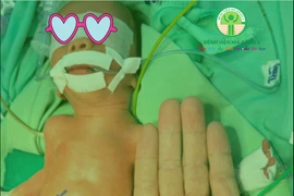 Giành lại sự sống cho trẻ sinh non nặng gần 1 kg bị viêm ruột hoại tử