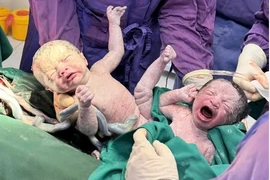 Cứu sản phụ và 2 thai nhi IVF tiền sản giật nặng đẻ non