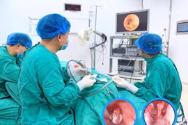 Trẻ 29 tháng tuổi không viêm tai bất ngờ phát hiện Cholesteatoma bẩm sinh