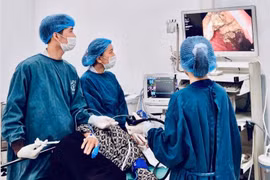 Đau bụng, buồn nôn vì khối bã thức ăn lớn mắc kẹt trong dạ dày
