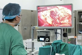 Người phụ nữ suýt vỡ nang gan khổng lồ gần 9cm