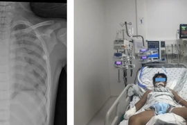 Nỗ lực cứu trẻ 10 tuổi đuối nước ngay tại hồ bơi