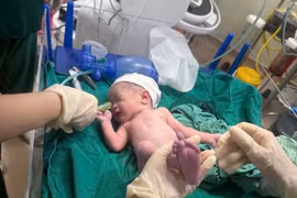 10 phút sinh tử giành lại sự sống cho hai mẹ con sản phụ co giật, mất ý thức