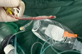 Hồi sức tim phổi 70 phút vẫn không cứu được bé 3 tuổi sặc thức ăn ở lớp