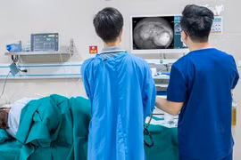 Tưởng rối loạn tiêu hóa do ăn uống không ngờ polyp đại tràng ung thư