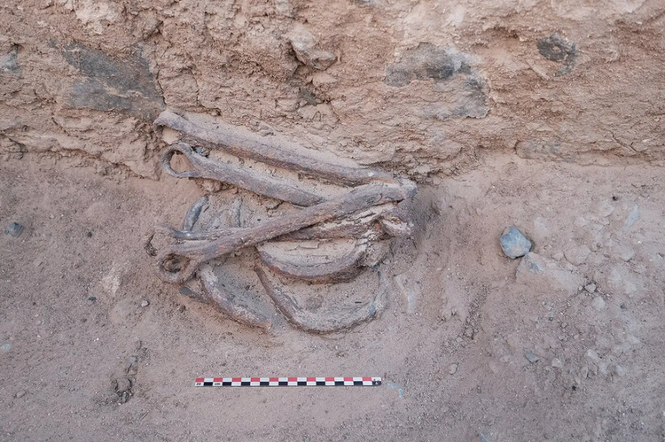 Su that tan bao sau dau vet xieng xich tai mo vang Ai Cap-Hinh-6