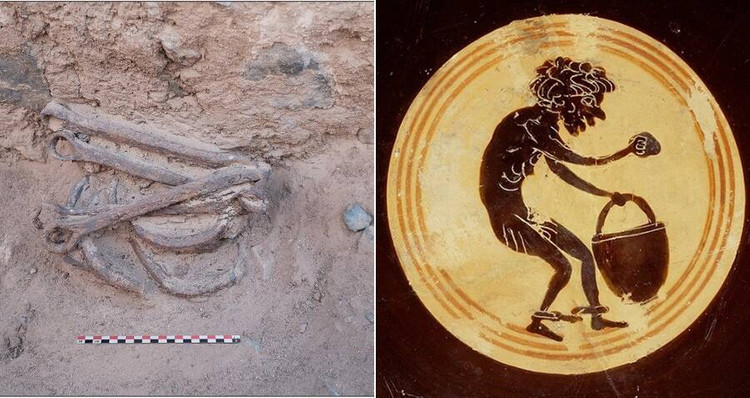 Su that tan bao sau dau vet xieng xich tai mo vang Ai Cap-Hinh-9