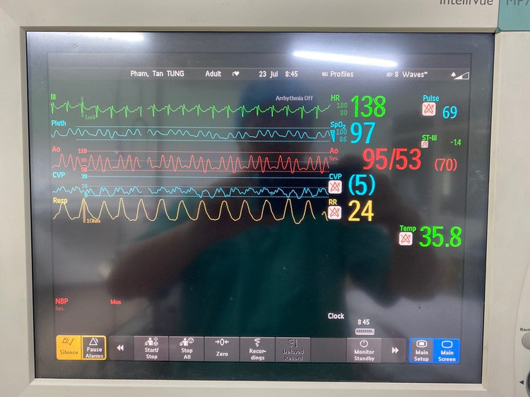 Hành trình ghép tim từ người chết não ở HN cứu bệnh nhân tại Quảng Nam - Hình 6 Hanh trinh ghep tim tu nguoi chet nao o HN cuu benh nhan tai Quang Nam-Hinh-6