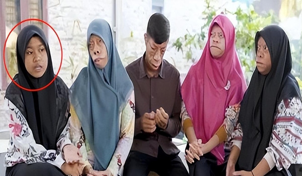 Người 'mặt ngựa' như bị nguyền rủa và câu chuyện đổi đời ngoạn mục - Hình 4 Nguoi 'mat ngua' nhu bi nguyen rua va cau chuyen doi doi ngoan muc-Hinh-4