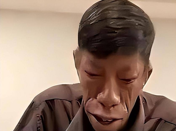 Người 'mặt ngựa' như bị nguyền rủa và câu chuyện đổi đời ngoạn mục - Hình 7 Nguoi 'mat ngua' nhu bi nguyen rua va cau chuyen doi doi ngoan muc-Hinh-7