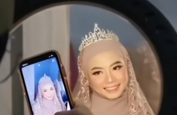 Người 'mặt ngựa' như bị nguyền rủa và câu chuyện đổi đời ngoạn mục - Hình 9 Nguoi 'mat ngua' nhu bi nguyen rua va cau chuyen doi doi ngoan muc-Hinh-9