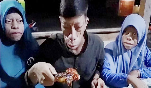 Người 'mặt ngựa' như bị nguyền rủa và câu chuyện đổi đời ngoạn mục - Hình 13 Nguoi 'mat ngua' nhu bi nguyen rua va cau chuyen doi doi ngoan muc-Hinh-13