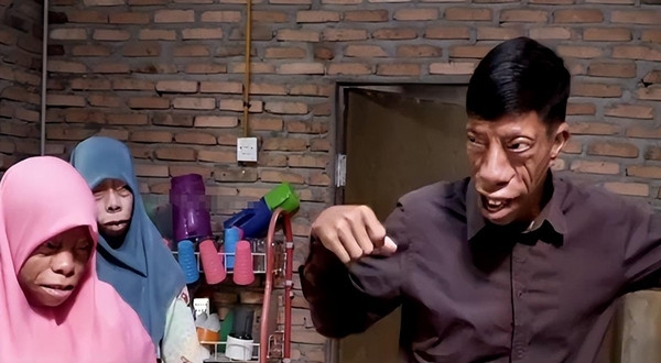 Người 'mặt ngựa' như bị nguyền rủa và câu chuyện đổi đời ngoạn mục - Hình 11 Nguoi 'mat ngua' nhu bi nguyen rua va cau chuyen doi doi ngoan muc-Hinh-11