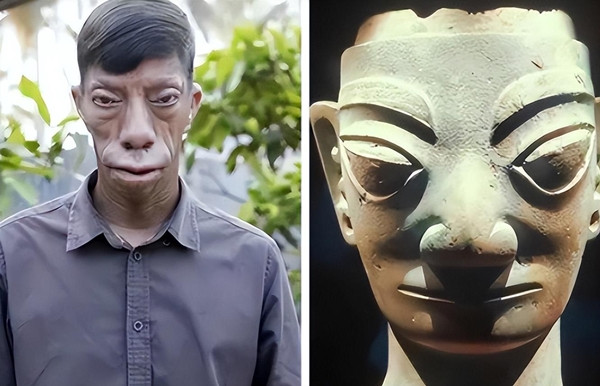 Người 'mặt ngựa' như bị nguyền rủa và câu chuyện đổi đời ngoạn mục - Hình 2 Nguoi 'mat ngua' nhu bi nguyen rua va cau chuyen doi doi ngoan muc-Hinh-2