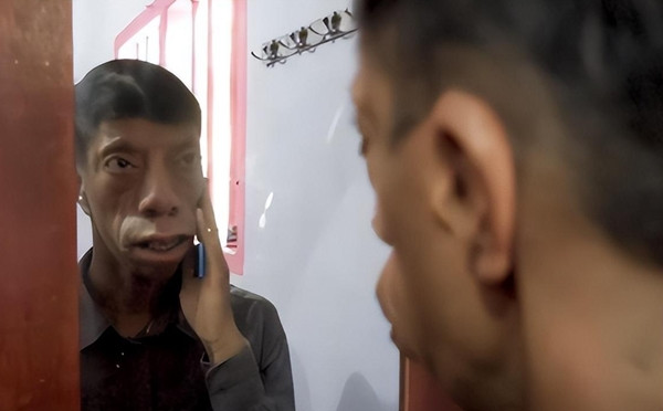 Người 'mặt ngựa' như bị nguyền rủa và câu chuyện đổi đời ngoạn mục - Hình 6 Nguoi 'mat ngua' nhu bi nguyen rua va cau chuyen doi doi ngoan muc-Hinh-6