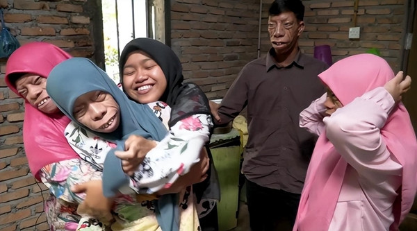 Người 'mặt ngựa' như bị nguyền rủa và câu chuyện đổi đời ngoạn mục - Hình 3 Nguoi 'mat ngua' nhu bi nguyen rua va cau chuyen doi doi ngoan muc-Hinh-3