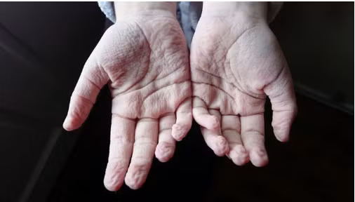 Giật mình dấu hiệu cơ thể mắc bệnh hiểm, triệu người bỏ qua - Hình 3