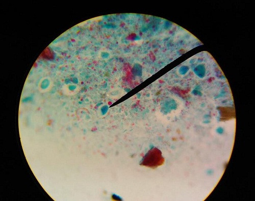 Uống nước lã, ăn thịt tái, tiếp xúc với vật nuôi,... làm tăng nguy cơ mắc bệnh sán gan nguy hiểm. Ảnh: SH